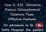 Image of shock therapy for Schizophrenic woman Washington DC USA, 1943, second 9 stock footage video 65675029091