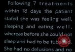 Image of woman suffering from Melancholia Washington DC USA, 1943, second 13 stock footage video 65675029094