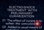 Image of electro-shock treatment administered to mental patient Washington DC USA, 1943, second 7 stock footage video 65675029095