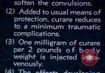 Image of electro-shock treatment administered to mental patient Washington DC USA, 1943, second 23 stock footage video 65675029095