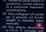 Image of electro-shock treatment administered to mental patient Washington DC USA, 1943, second 26 stock footage video 65675029095