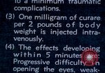 Image of electro-shock treatment administered to mental patient Washington DC USA, 1943, second 30 stock footage video 65675029095