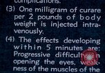 Image of electro-shock treatment administered to mental patient Washington DC USA, 1943, second 32 stock footage video 65675029095