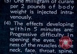 Image of electro-shock treatment administered to mental patient Washington DC USA, 1943, second 34 stock footage video 65675029095