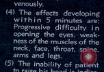 Image of electro-shock treatment administered to mental patient Washington DC USA, 1943, second 39 stock footage video 65675029095