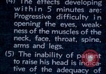 Image of electro-shock treatment administered to mental patient Washington DC USA, 1943, second 42 stock footage video 65675029095