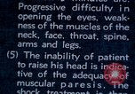 Image of electro-shock treatment administered to mental patient Washington DC USA, 1943, second 45 stock footage video 65675029095