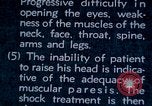 Image of electro-shock treatment administered to mental patient Washington DC USA, 1943, second 46 stock footage video 65675029095