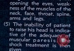Image of electro-shock treatment administered to mental patient Washington DC USA, 1943, second 47 stock footage video 65675029095