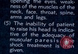 Image of electro-shock treatment administered to mental patient Washington DC USA, 1943, second 48 stock footage video 65675029095