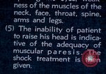 Image of electro-shock treatment administered to mental patient Washington DC USA, 1943, second 49 stock footage video 65675029095