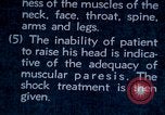 Image of electro-shock treatment administered to mental patient Washington DC USA, 1943, second 50 stock footage video 65675029095
