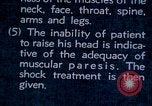 Image of electro-shock treatment administered to mental patient Washington DC USA, 1943, second 52 stock footage video 65675029095