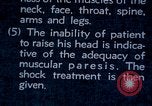 Image of electro-shock treatment administered to mental patient Washington DC USA, 1943, second 53 stock footage video 65675029095
