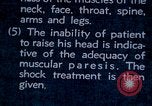 Image of electro-shock treatment administered to mental patient Washington DC USA, 1943, second 54 stock footage video 65675029095