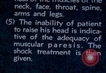 Image of electro-shock treatment administered to mental patient Washington DC USA, 1943, second 55 stock footage video 65675029095
