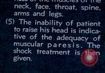 Image of electro-shock treatment administered to mental patient Washington DC USA, 1943, second 56 stock footage video 65675029095