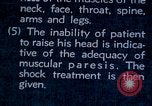 Image of electro-shock treatment administered to mental patient Washington DC USA, 1943, second 57 stock footage video 65675029095