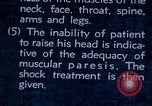 Image of electro-shock treatment administered to mental patient Washington DC USA, 1943, second 58 stock footage video 65675029095