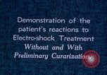 Image of electro-shock treatment administered to mental patient Washington DC USA, 1943, second 59 stock footage video 65675029095