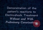 Image of electro-shock treatment administered to mental patient Washington DC USA, 1943, second 61 stock footage video 65675029095