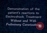 Image of electro-shock treatment administered to mental patient Washington DC USA, 1943, second 62 stock footage video 65675029095