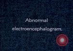 Standbild electroencephalograms Washington DC USA, 1943, aus Sekunde 30 historischem Filmmaterial Videoclip 65675029098