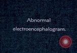 Standbild electroencephalograms Washington DC USA, 1943, aus Sekunde 31 historischem Filmmaterial Videoclip 65675029098