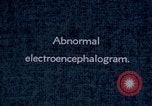Standbild electroencephalograms Washington DC USA, 1943, aus Sekunde 32 historischem Filmmaterial Videoclip 65675029098