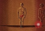 Immagine di Sifilide United States USA, 1964, secondo 58 filmato di repertorio 65675029103