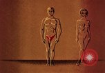 Immagine di Sifilide United States USA, 1964, secondo 59 filmato di repertorio 65675029103