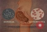 Immagine di La gonorrea United States USA, 1964, secondo 1 filmato di repertorio 65675029104