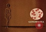 Immagine di La gonorrea United States USA, 1964, secondo 12 filmato di repertorio 65675029104