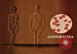 Immagine di La gonorrea United States USA, 1964, secondo 13 filmato di repertorio 65675029104