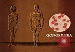Immagine di La gonorrea United States USA, 1964, secondo 14 filmato di repertorio 65675029104