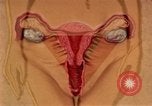 Immagine di La gonorrea United States USA, 1964, secondo 30 filmato di repertorio 65675029104