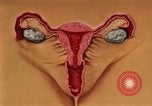 Immagine di La gonorrea United States USA, 1964, secondo 31 filmato di repertorio 65675029104