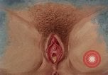 Immagine di La gonorrea United States USA, 1964, secondo 40 filmato di repertorio 65675029104