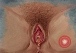 Immagine di La gonorrea United States USA, 1964, secondo 44 filmato di repertorio 65675029104
