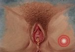 Immagine di La gonorrea United States USA, 1964, secondo 45 filmato di repertorio 65675029104