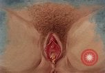 Immagine di La gonorrea United States USA, 1964, secondo 46 filmato di repertorio 65675029104