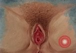 Immagine di La gonorrea United States USA, 1964, secondo 54 filmato di repertorio 65675029104