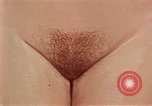 Immagine di La gonorrea United States USA, 1964, secondo 61 filmato di repertorio 65675029104