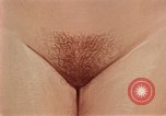 Immagine di La gonorrea United States USA, 1964, secondo 62 filmato di repertorio 65675029104