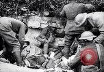 Image -américain du 18e des troupes d'infanterie Exermont France, 1918, de la seconde 43 séquences d'archives historiques vidéo 65675029583
