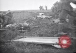 Image blessés les troupes américaines Valsery Couveres-et-France, 1918, de la seconde 13 séquences d'archives historiques vidéo 65675029584
