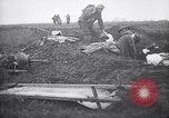 Image blessés les troupes américaines Valsery Couveres-et-France, 1918, de la seconde 16 séquences d'archives historiques vidéo 65675029584