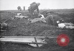 Image blessés les troupes américaines Valsery Couveres-et-France, 1918, de la seconde 17 séquences d'archives historiques vidéo 65675029584