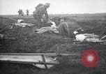 Image blessés les troupes américaines Valsery Couveres-et-France, 1918, de la seconde 18 séquences d'archives historiques vidéo 65675029584