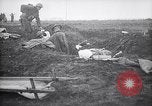 Image blessés les troupes américaines Valsery Couveres-et-France, 1918, de la seconde 21 séquences d'archives historiques vidéo 65675029584